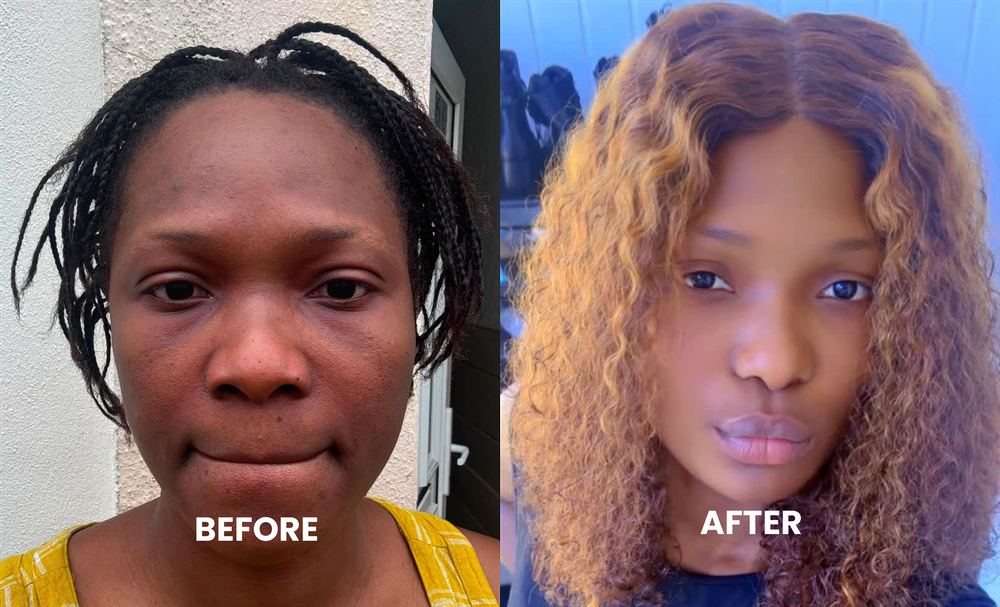 Before and after using the Gracial Radiance Set